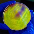 
            Petri dish culture plate showing Clostridium difficile bacterial colonies illuminated using long-wave UV irradiation. Image: CDC / Melissa Dankel